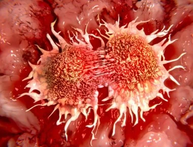 Νέα ανησυχητική έρευνα για τον καρκίνο – Τα 7 πράγματα που πρέπει να αποφεύγετε